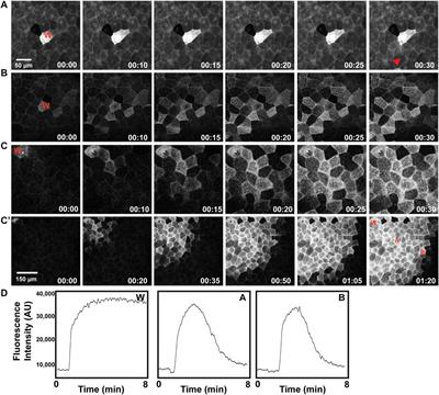 Bring the pain: wounding reveals a transition from cortical excitability to epithelial excitability in Xenopus embryos